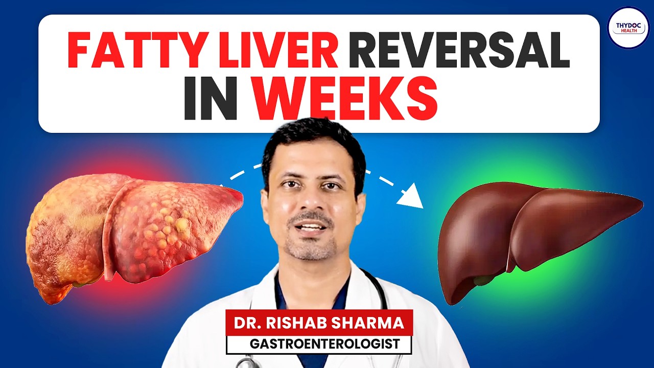 Fatty Liver का इलाज सिर्फ Diet और Routine से | कोई दवा नहीं चाहिए!