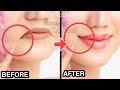 8mins Anti-Aging Face Exercise To Lift Up Mouth Corners Fat! Lip Corners Lift, Face Lifting Massage