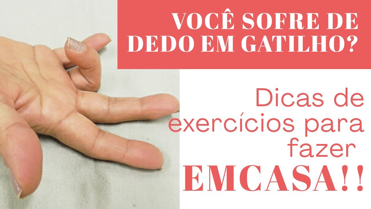 Como curar DEDO EM GATILHO? DICAS DE EXERCÍCIOS YouTube Como curar DEDO EM GATILHO? DICAS DE EXERCÍCIOS YouTube