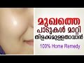 മുഖം വെട്ടിത്തിളങ്ങാൻ | home remedy for skin whitening | latest malayalam health tips