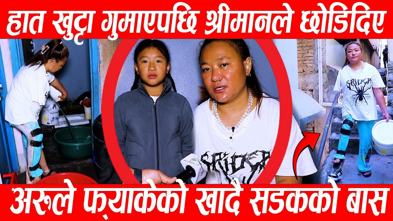हात खुट्टा गुमाएपछि श्रीमानले बिचल्लि बनाएर छोडिदिए,अरुले फ्यालेको खादै  आमाछोरिको सडकको बास