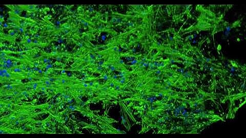3D images of bone marrow model(HUMIMIC Chip2 96-well / AX Confocal Microscope)