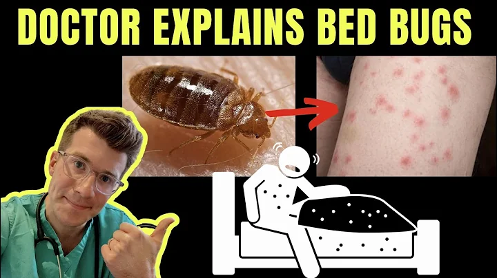 Doctor explains BED BUGS - including SYMPTOMS, TREATMENT AND PREVENTION ( +PHOTOS!) - DayDayNews