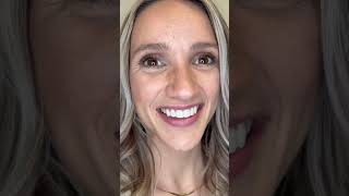 Stunning Porcelain Veneers Transformations | Real Smiles from Gordon Dental in Kansas City #veneers