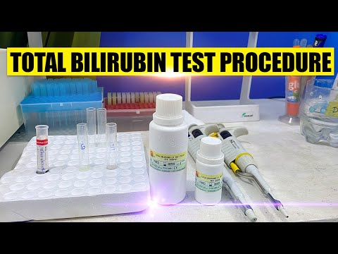 Bilirubin Test Procedure
