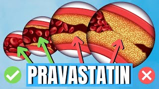 How to use Pravastatin (Pravachol) - Uses, Side Effects, Dosage - Doctor Explains Pravastatin With Dr Clara Tee