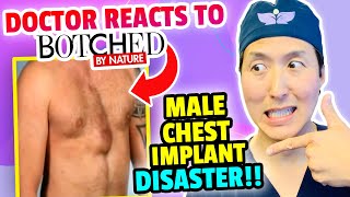 Plastic Surgeon Reacts to BOTCHED by NATURE: Implant MESS in a MALE!