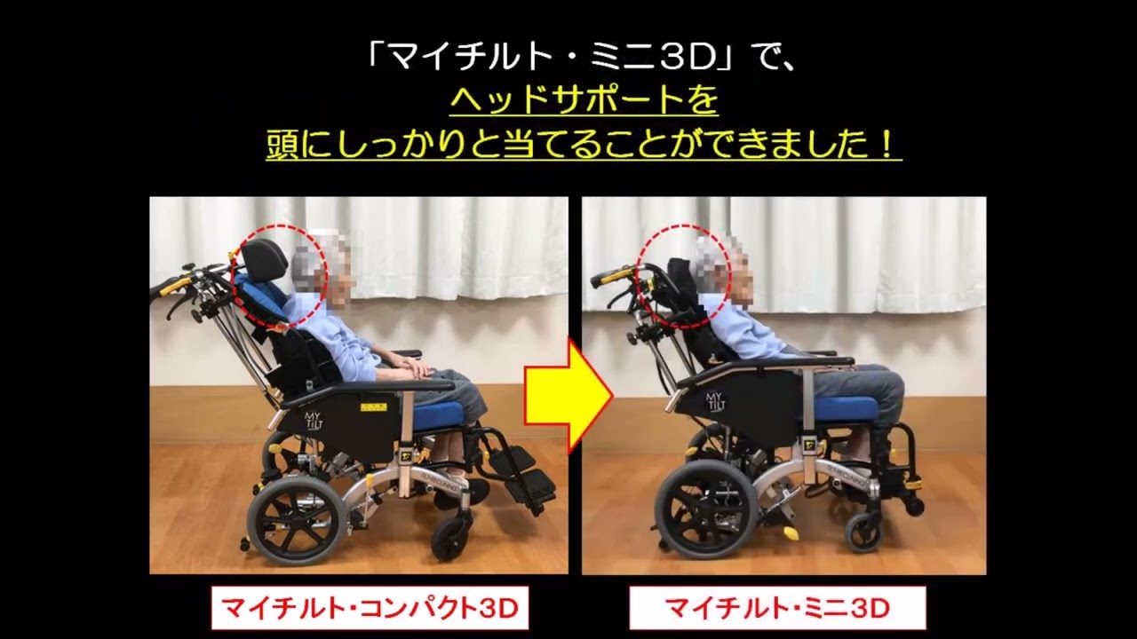 Amazon 車椅子 フットレスト取り外し Amazon リクライニング車椅子 