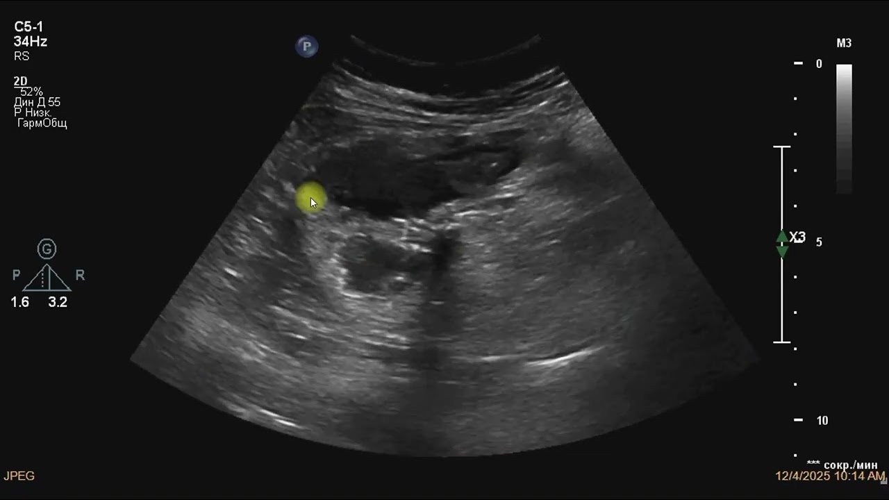 Почему болит живот? Часть 2 Пояснительная. 