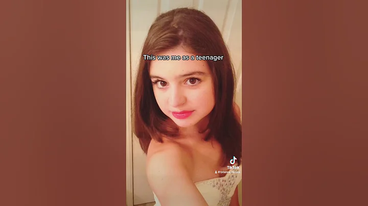 WHAT HAPPENED TO MY FACE?🥹#babyface #funny #teenager