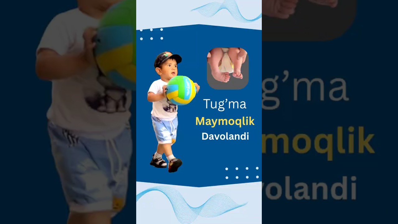 Maymoqlikni Ponseti usulida davolash