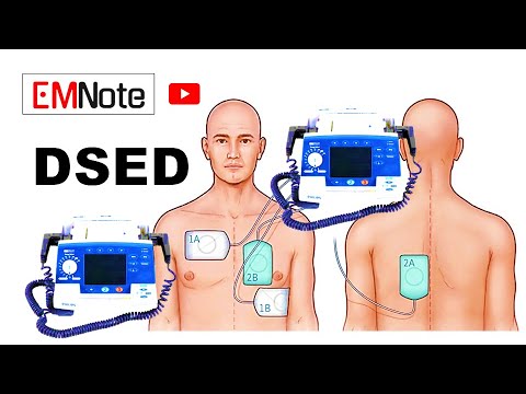 DSED (Double Sequential External Defibrillation)