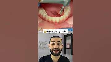 تسوية الاسنان في ٦٠ ثانية 