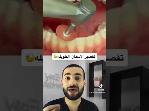 تسوية الاسنان في ٦٠ ثانية