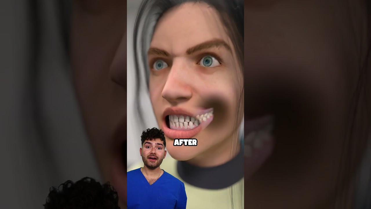 Dentist Explains: Cracked Jaw !?