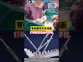 脊柱侧弯手术动画:钉棒掰直扭曲的脊柱#脊柱侧弯 #健康 #医学科普 #手术 #scoliosis #surgery