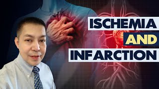 ECG Myocardial Ischemia and Infarction