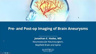 Pre- and Post-op Imaging of Brain Aneurysms w/ Dr. Jonathan Hodes