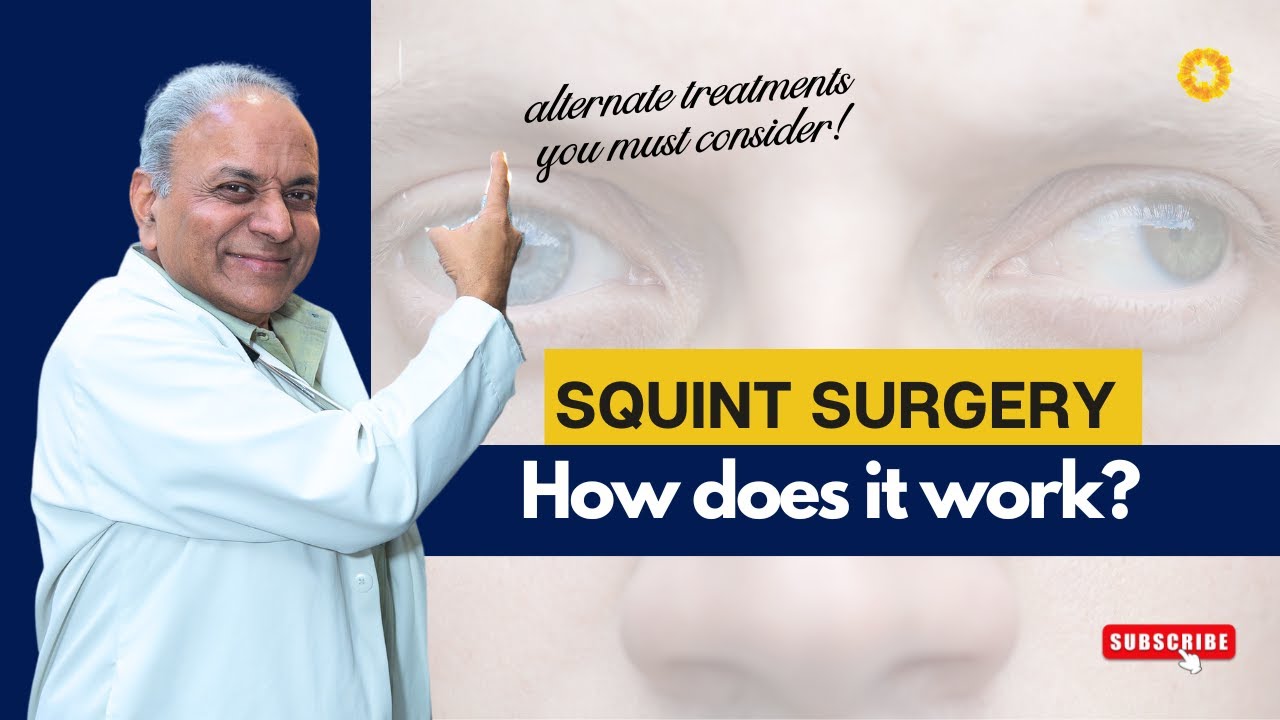 Squint Eye Surgery Explained: Procedure, Risks & Best Non-Surgical Alternatives | भैंगापन का इलाज