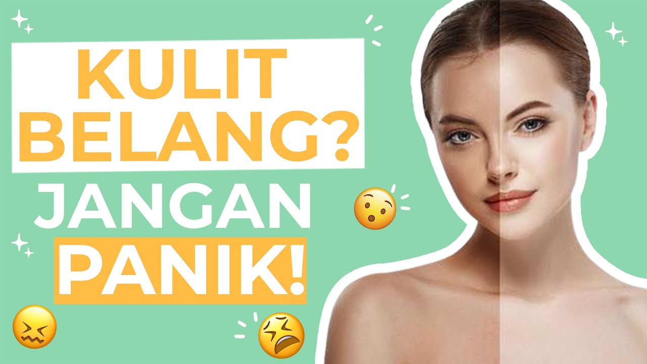 AMPUH! 4 Cara Meratakan Warna Kulit Badan yang Belang!