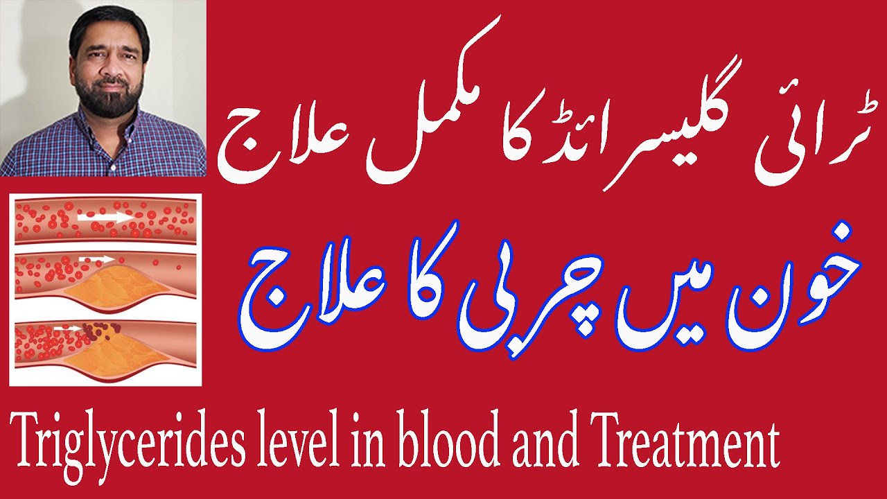 Triglycerides Kam Karne Kelye Dawai Kab Leni Chaheye When To Take Triglycerides Medicine In Urdu Youtube