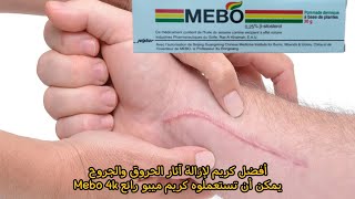 أفضل كريم لإزالة آثار الحروق يمكن أن تستعملوه رائع Mebo 4k