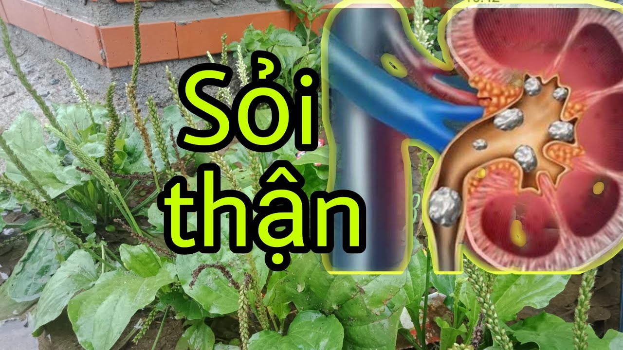 Qhia Tshuaj haus muaj pob zeb hauv raum - Zais zis , Chữa sỏi thận tại nhà