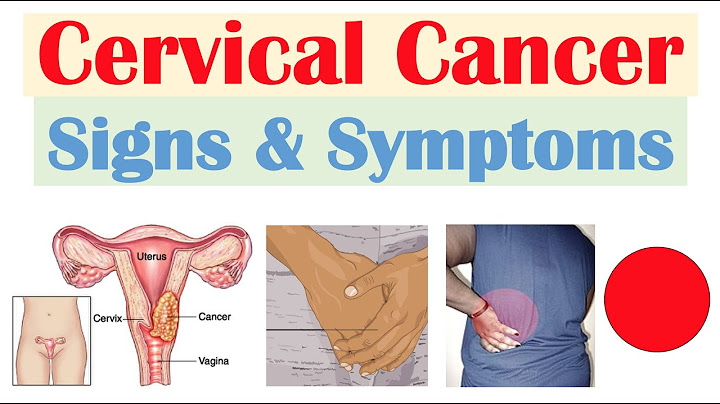 Conditions that may have vaginal discharge as a symptom