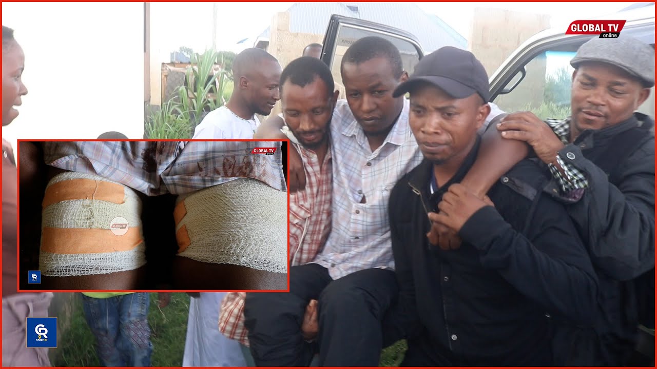 WAWILI WAPIGWA RISASI ARUSHA KIMAKOSA - WAJERUHIWA VIBAYA na WATU WALIOJITAMBULISHA ni USALAMA...