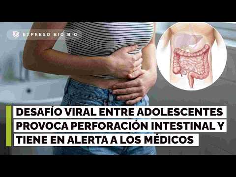 Desafío viral de ingerir imanes entre adolescentes genera alerta médica por perforaciones intestinales