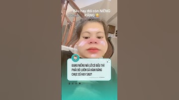Chị em có ý định niềng răng lưu ý nhé  #nhatkyniengrang #niengrang  #nhakhoa #viral