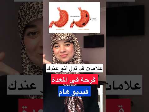 شاك أنو عندك قرحة في المعدة