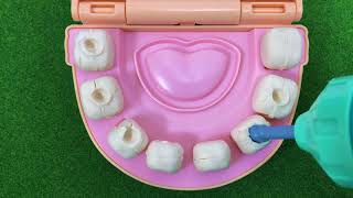 【ねんどで歯医者さんごっこ! 】虫歯を抜いたり、電動ドリルを使って虫歯を削ったり、歯磨きのマネもできる【対象年齢：3才以上】