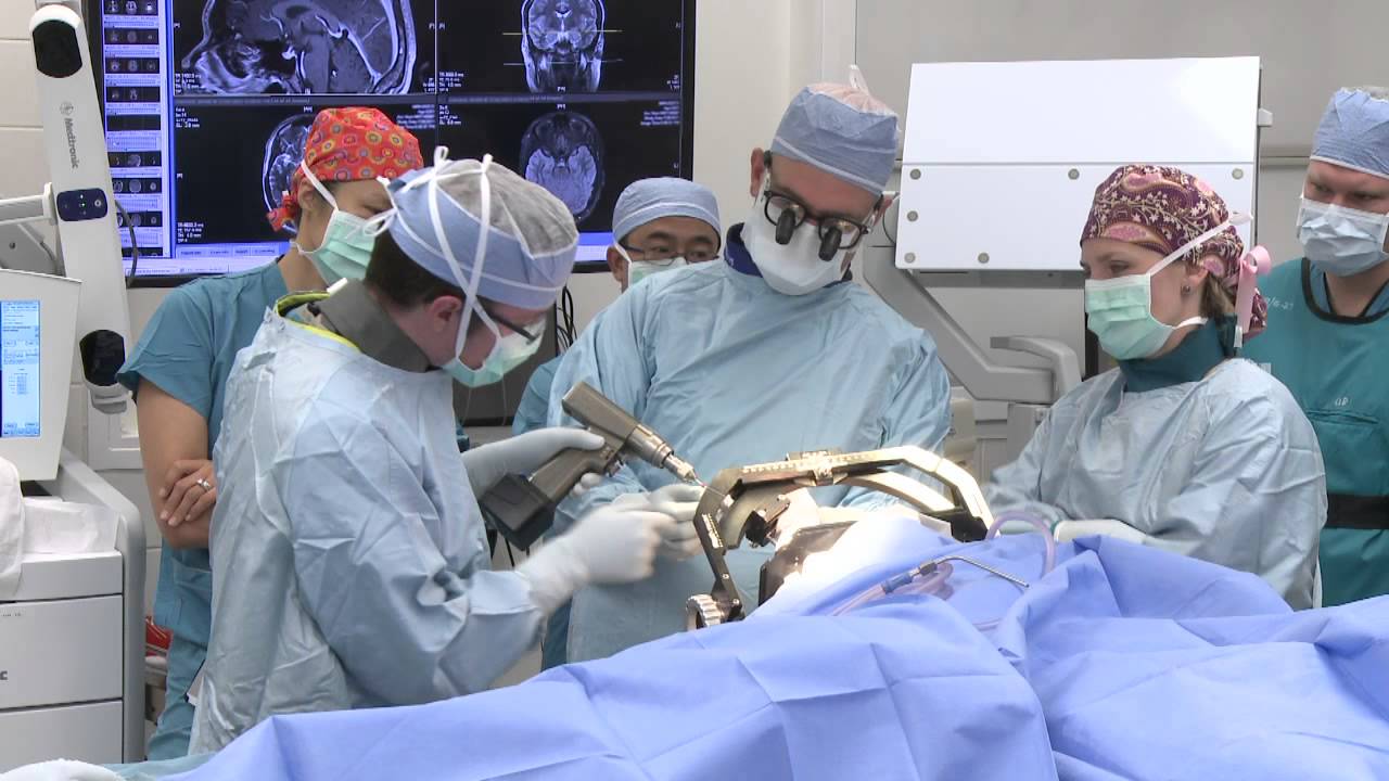 What Happens During a Laser Ablation Surgery for Epilepsy?