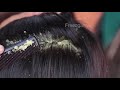 Dandruff Removal Satisfying #634