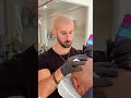 Scalp Micropigmentation in Action ⚡️