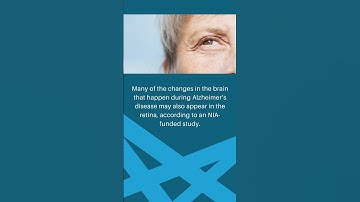 #nia #research #aging #guthealth #gutbrainaxis #brain #alzheimers #eyehealth  #vitamin  6/30/2023