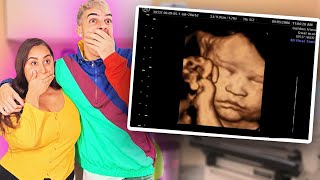 SEEING OUR SON FOR THE FIRST TIME..... *4D ULTRASOUND* by The Moco Family 23,097 views 3 years ago 13 minutes, 49 seconds