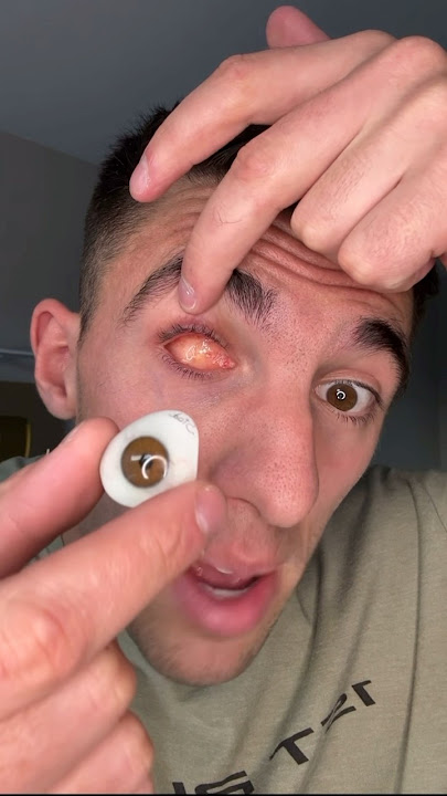 MY LUXURY EYEBALL 😮