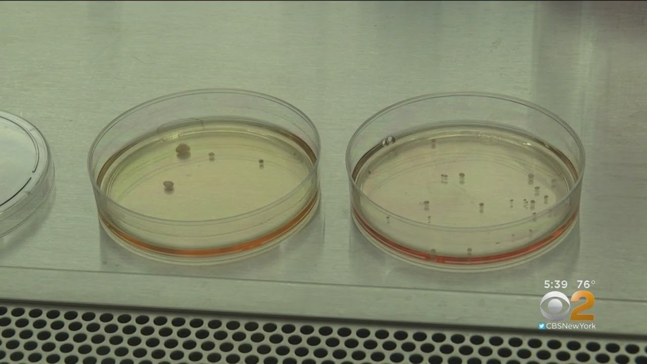 cbs new york weather Creating Replica Brains May Help Find Treatment For Tumors