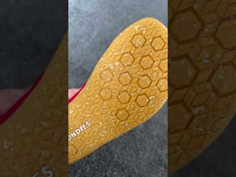 What Barefoot Shoes Do To Your Feet...5 Years Later