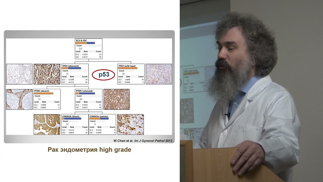 Новый взгляд на рак эндометрия от Никиты Савелова