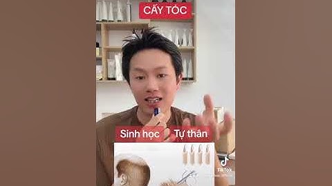 Cấy tóc là gì? Trường hợp nào nên cấy tóc?