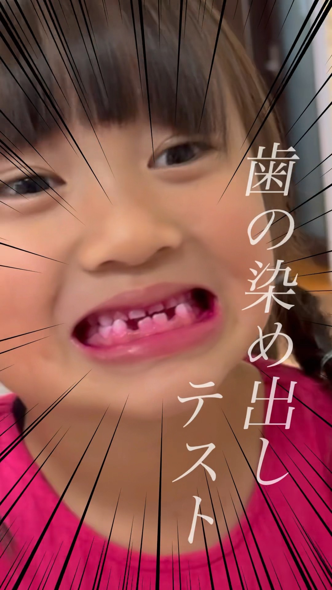 The results of the annual tooth staining test at elementary school