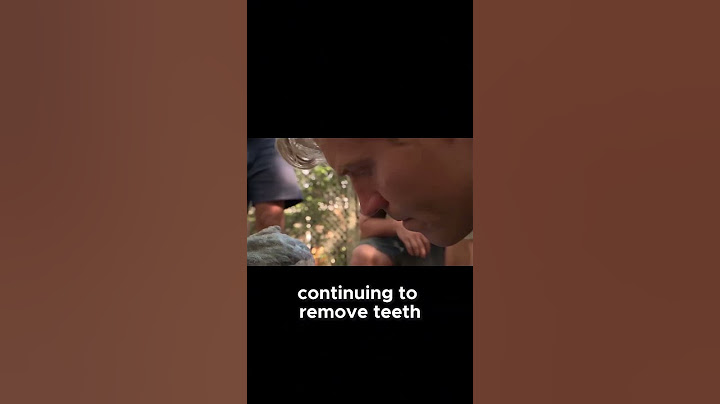 Vet Removes Massive Teeth from Croc!