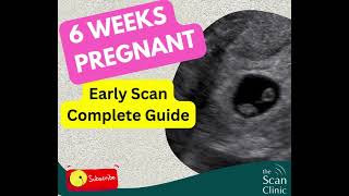 Early Pregnancy 6 Week Ultrasound Explained!