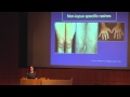 Lupus, The Skin & Hair - Dr Abby Macbeth (East Anglia Lupus Info Day, Oct 2013)