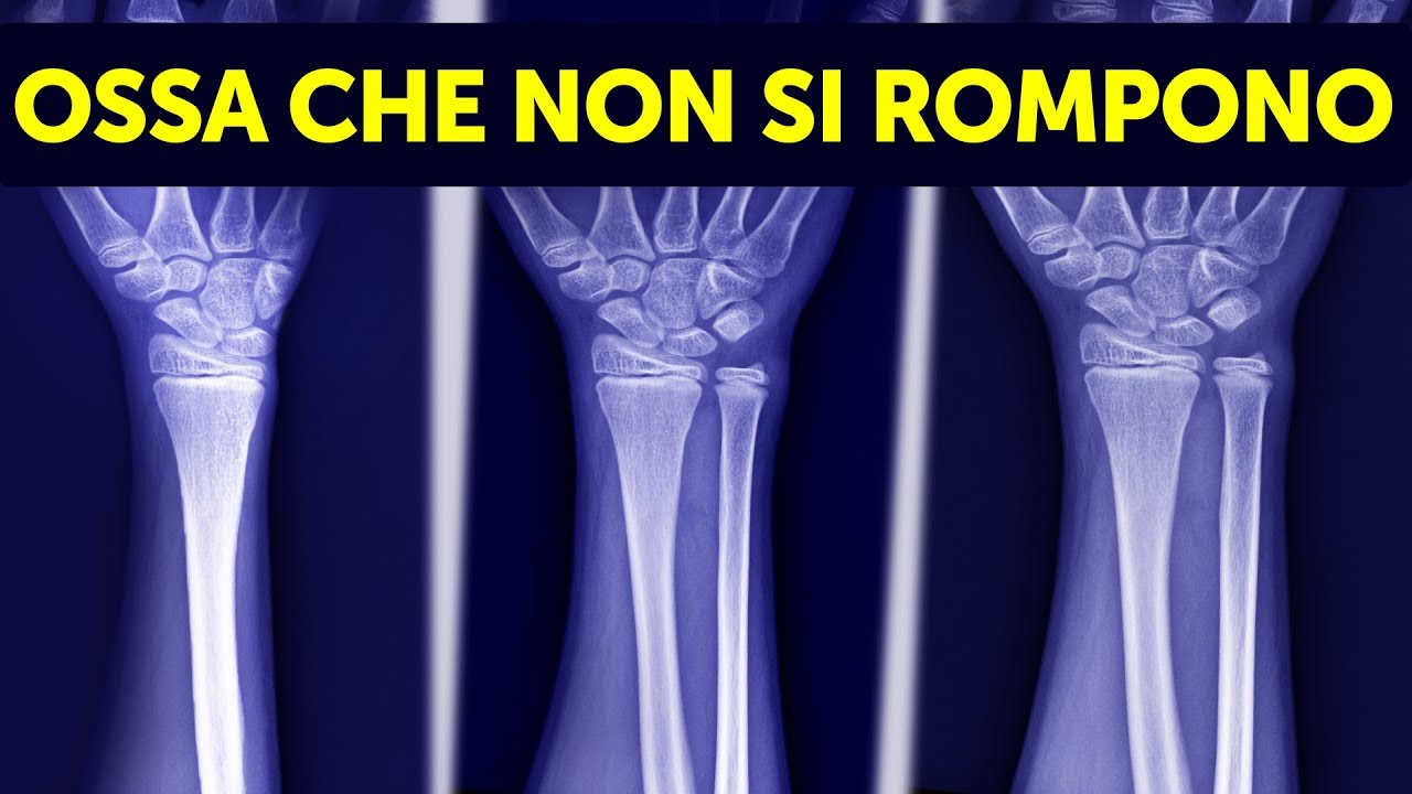 12 Tratti Estremamente Rari Che Hanno Solo Poche Persone