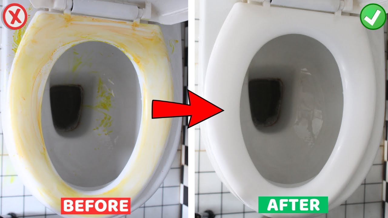 Remove Yellow Stains from Toilet Seat Fast | DIY Cleaning Tips