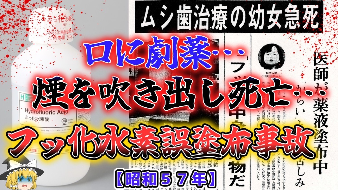 【ゆっくり解説】「痛い!からい!」3歳幼女の口に劇薬が……「昭和57年 八王子歯科医フッ化水素誤塗布事故」